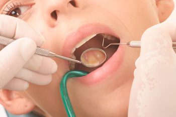 Woman-getting-teeth-cleaned